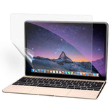 Macbook Pro 13 Retina PET Skyddsfilm - Genomskinlig