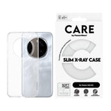 CARE by PanzerGlass Honor 400 Fashionable Transparent X-Ray Soft Basic Case - Genomskinlig