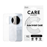 CARE by PanzerGlass Honor 400 Pro Fashionable Transparent X-Ray Soft Basic Case - Genomskinlig