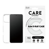 Xiaomi 17 Pro CARE by PanzerGlass FASHION X-Ray Soft Basic Skal - Genomskinlig